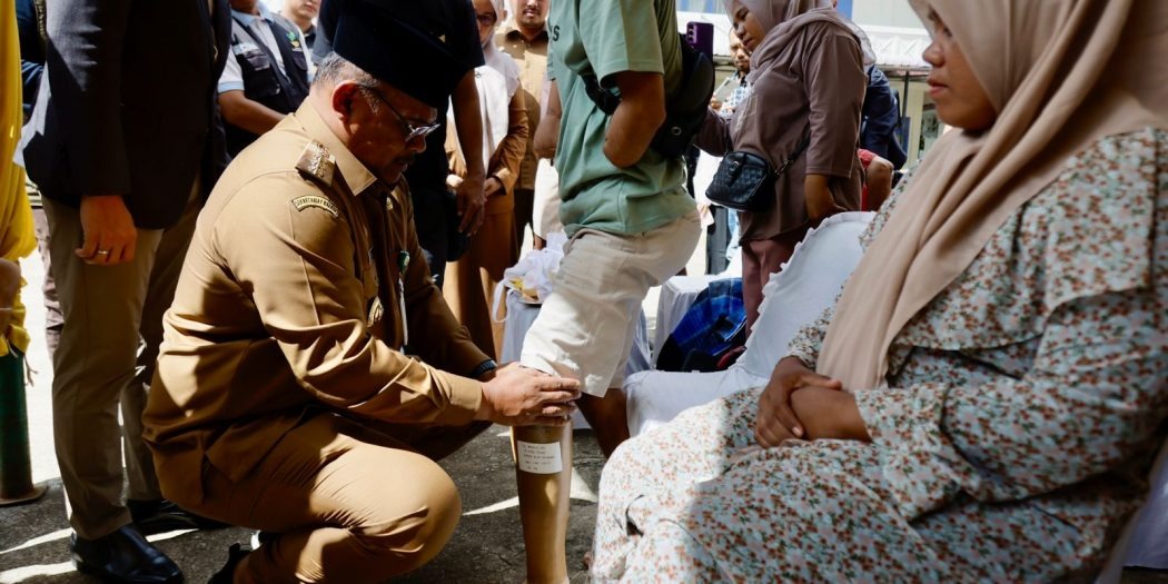 Pj Gubernur Safrizal Pasangkan Kaki Palsu untuk Penyandang Disabilitas